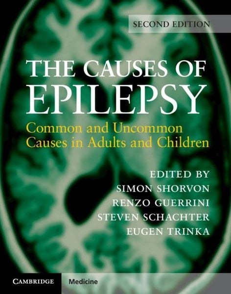 Produktbild: Causes of Epilepsy
