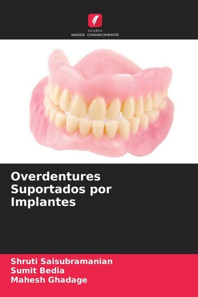 Produktbild: Overdentures Suportados por Implantes