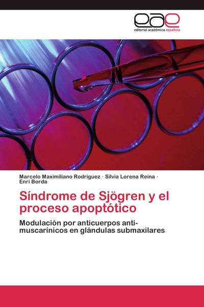 Produktbild: S&iacute;ndrome de Sj&ouml;gren y el proceso apopt&oacute;tico
