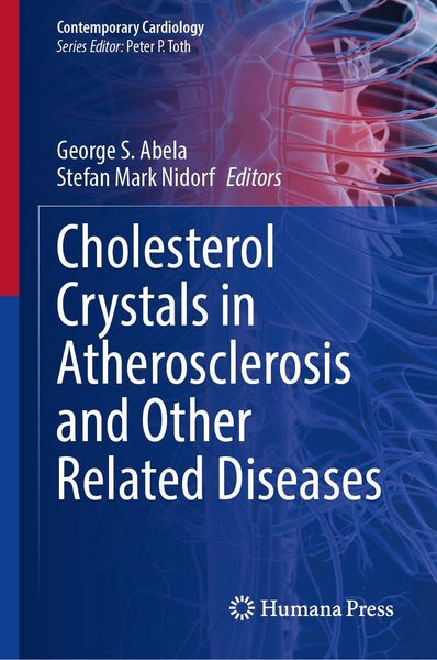 Produktbild: Cholesterol Crystals in Atherosclerosis and Other Related Diseases