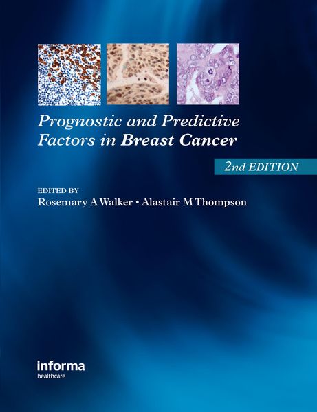 Produktbild: Prognostic and Predictive Factors in Breast Cancer