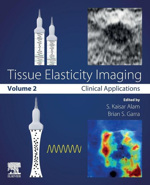 Produktbild: Tissue Elasticity Imaging