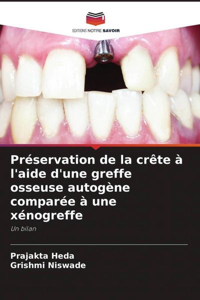 Produktbild: Pr&eacute;servation de la cr&ecirc;te &agrave; l'aide d'une greffe osseuse autog&egrave;ne compar&eacute;e &agrave; une x&eacute;nogreffe