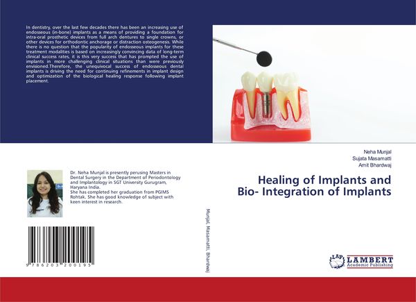Produktbild: Healing of Implants and Bio- Integration of Implants