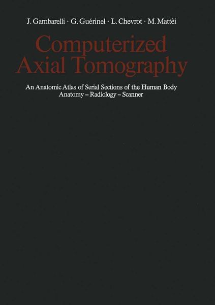 Produktbild: Computerized Axial Tomography