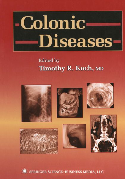 Produktbild: Colonic Diseases