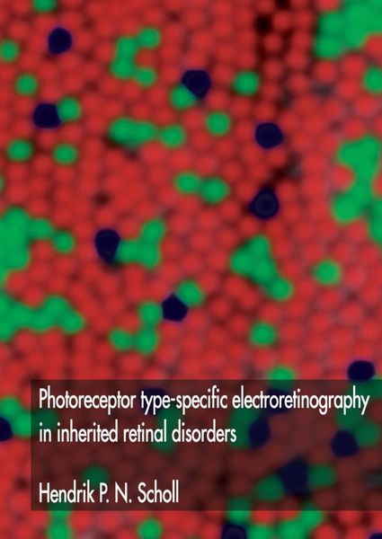 Produktbild: Photoreceptor type-specific electroretinography in inherited retinal disorders