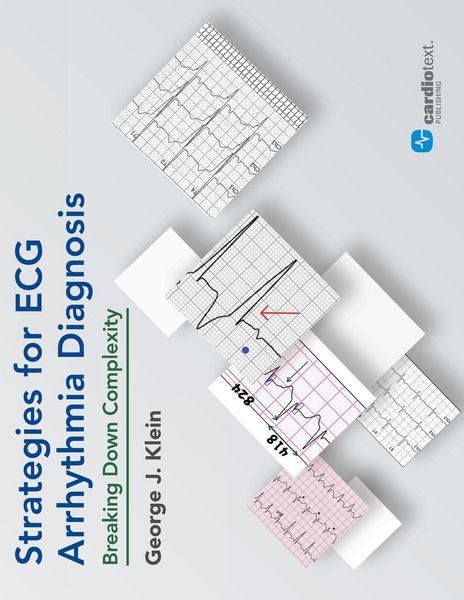 Produktbild: Strategies for ECG Arrhythmia Diagnosis