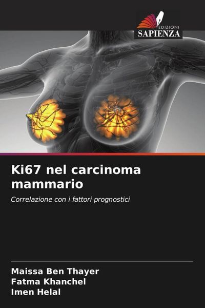 Produktbild: Ki67 nel carcinoma mammario