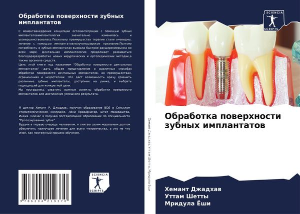 Produktbild: Obrabotka powerhnosti zubnyh implantatow