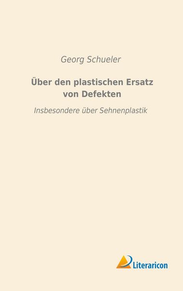 Produktbild: &Uuml;ber den plastischen Ersatz von Defekten