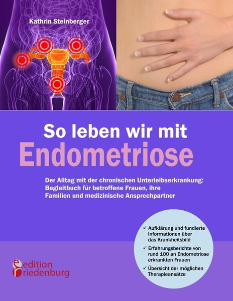 Produktbild: So leben wir mit Endometriose - Der Alltag mit der chronischen Unterleibserkrankung: Begleitbuch f&uuml;r betroffene Frauen, ihre Familien und medizinische