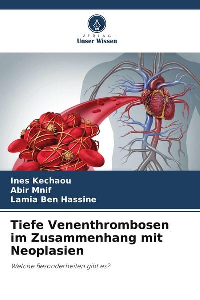 Tiefe Venenthrombosen im Zusammenhang mit Neoplasien, Taschenbuch von Ines Kechaou , Abir Mnif , Lamia Ben Hassine, Verlag Unser Wissen, 9786209548284