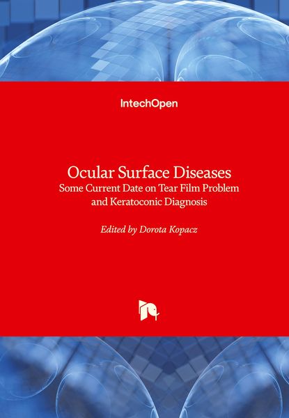 Produktbild: Ocular Surface Diseases