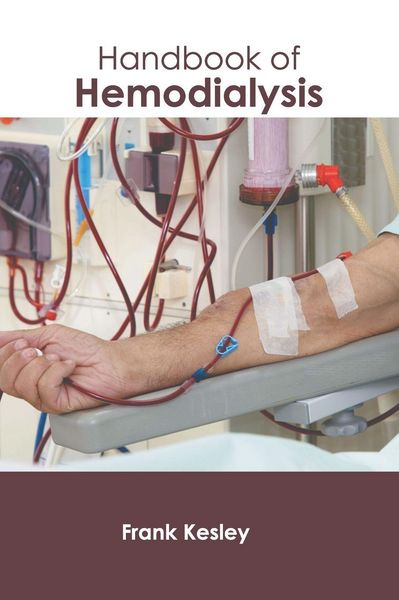 Produktbild: Handbook of Hemodialysis