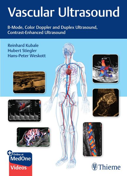 Produktbild: Vascular Ultrasound