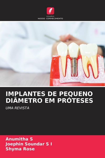 Produktbild: Implantes De Pequeno Di&acirc;metro Em Pr&oacute;teses