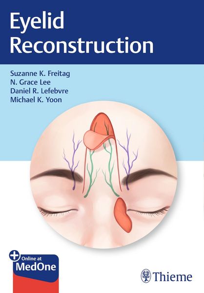 Produktbild: Eyelid Reconstruction