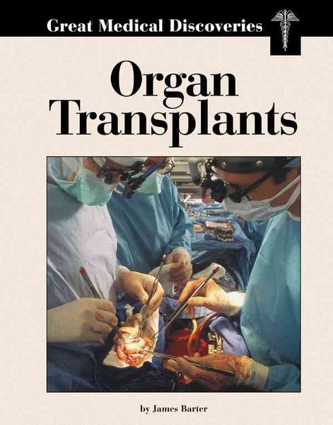 Produktbild: Organ Transplants