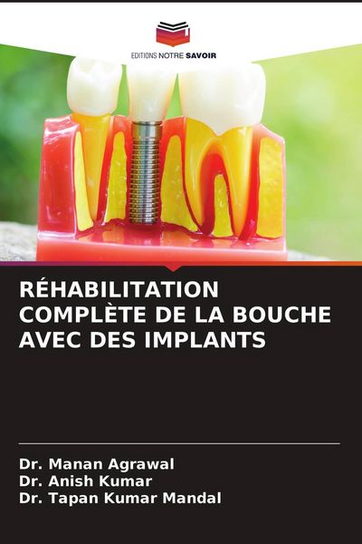 Produktbild: R&eacute;habilitation Compl&egrave;te De La Bouche Avec des Implants