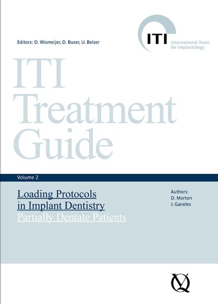 Produktbild: Loading Protocols in Implant Dentistry
