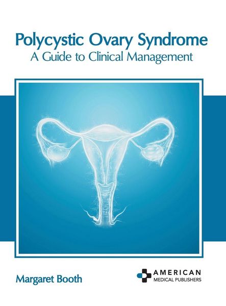 Produktbild: Polycystic Ovary Syndrome: A Guide to Clinical Management