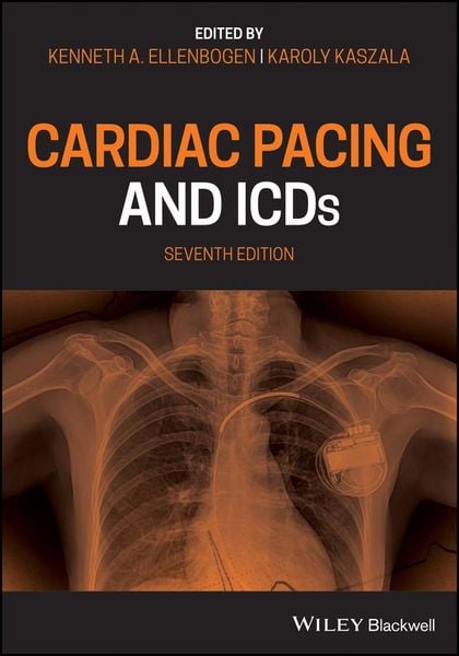 Produktbild: Cardiac Pacing and Icds