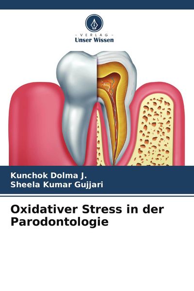 Oxidativer Stress in der Parodontologie, Taschenbuch von Kunchok Dolma J. , Sheela kumar Gujjari, Verlag Unser Wissen, 9786205080870