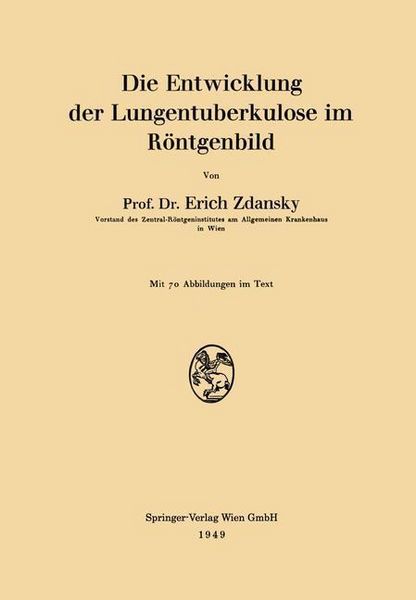 Produktbild: Die Entwicklung der Lungentuberkulose im R&ouml;ntgenbild