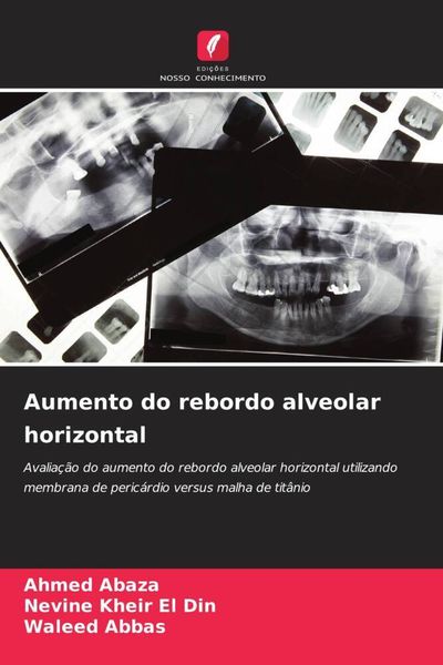 Produktbild: Aumento do rebordo alveolar horizontal