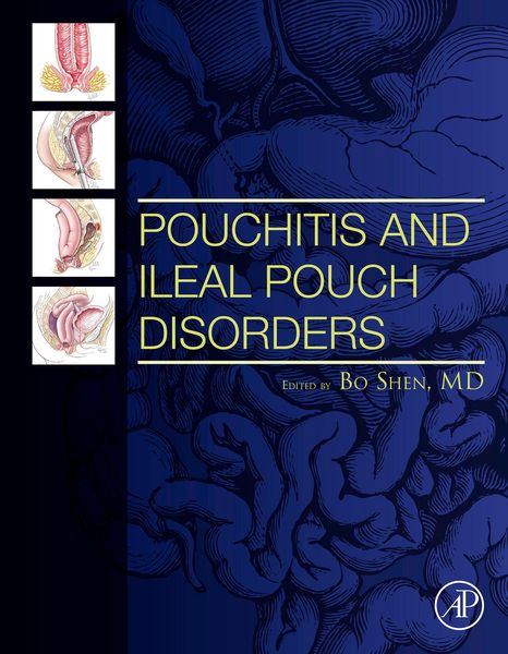 Produktbild: Pouchitis and Ileal Pouch Disorders
