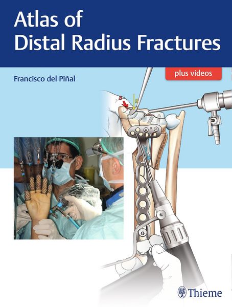 Produktbild: Atlas of Distal Radius Fractures