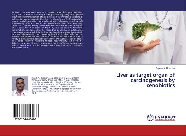 Produktbild: Liver as target organ of carcinogenesis by xenobiotics