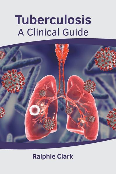 Produktbild: Tuberculosis