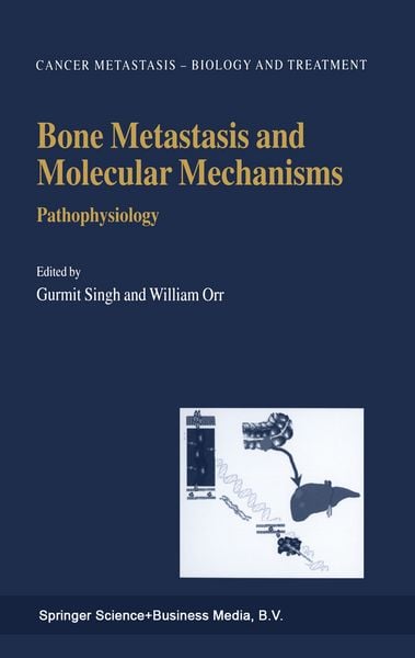 Produktbild: Bone Metastasis and Molecular Mechanisms