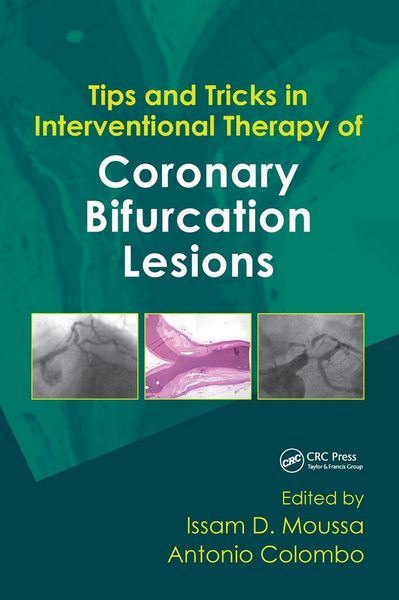 Produktbild: Tips and Tricks in Interventional Therapy of Coronary Bifurcation Lesions