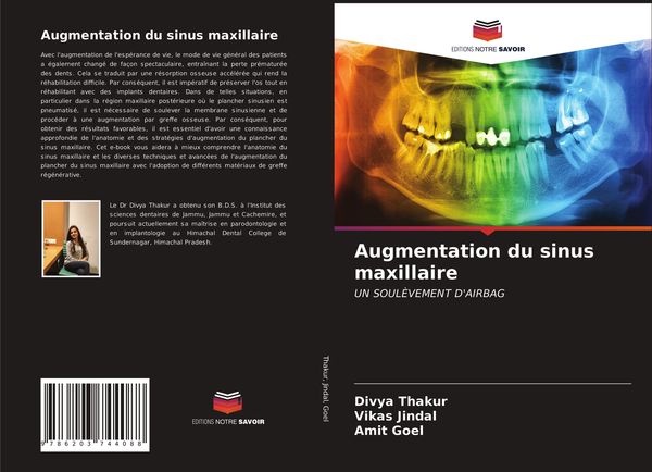 Produktbild: Augmentation du sinus maxillaire