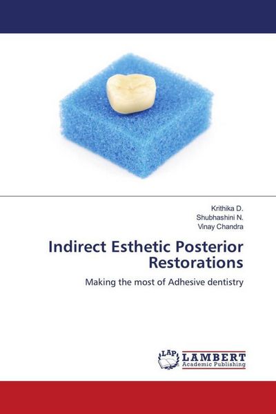 Produktbild: Indirect Esthetic Posterior Restorations