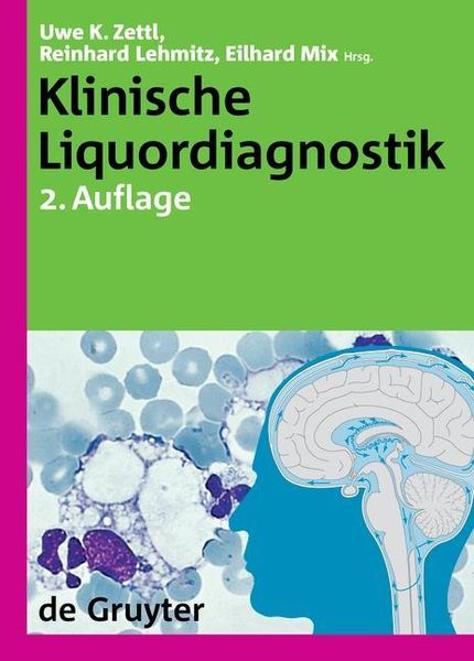 Produktbild: Klinische Liquordiagnostik