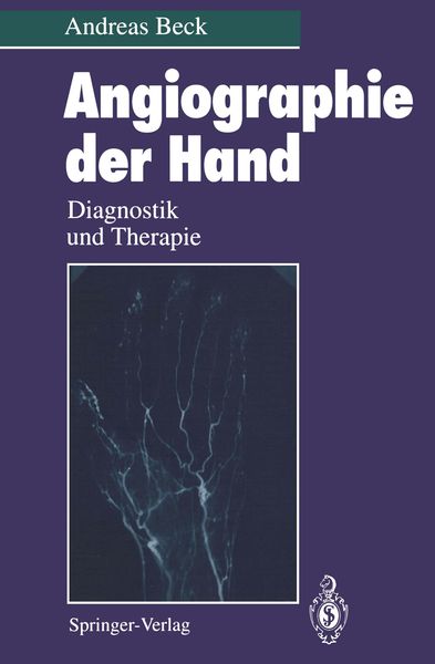 Angiographie der Hand, Taschenbuch von Andreas Beck, Springer Berlin, 9783642789243