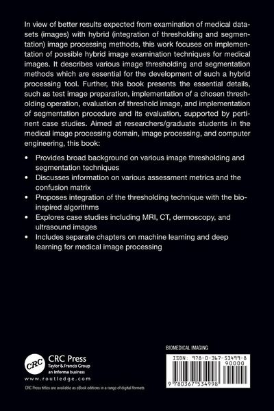 Produktbild: Hybrid Image Processing Methods for Medical Image Examination