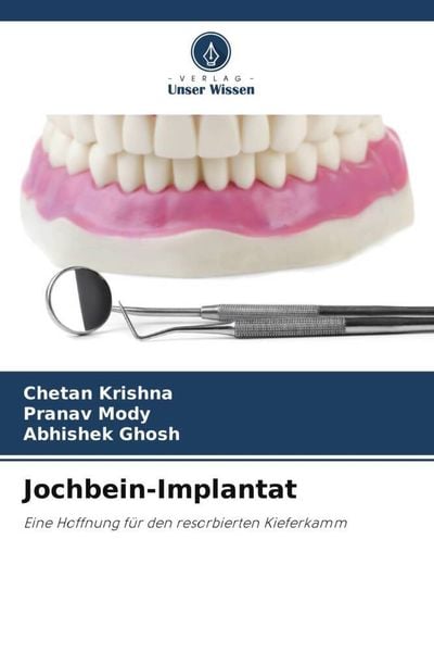 Produktbild: Jochbein-Implantat