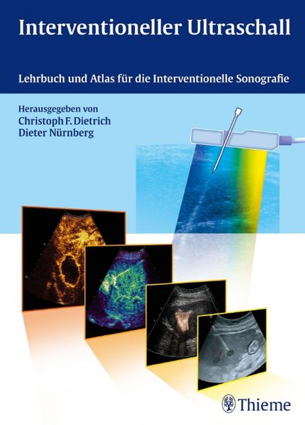 Produktbild: Interventioneller Ultraschall