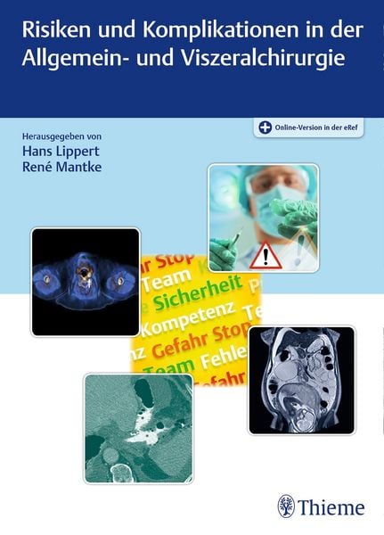 Produktbild: Risiken und Komplikationen in der Allgemein- und Viszeralchirurgie