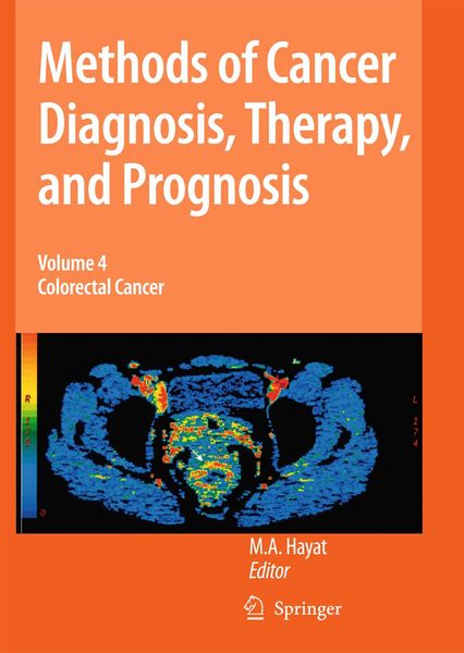 Produktbild: Methods of Cancer Diagnosis, Therapy and Prognosis
