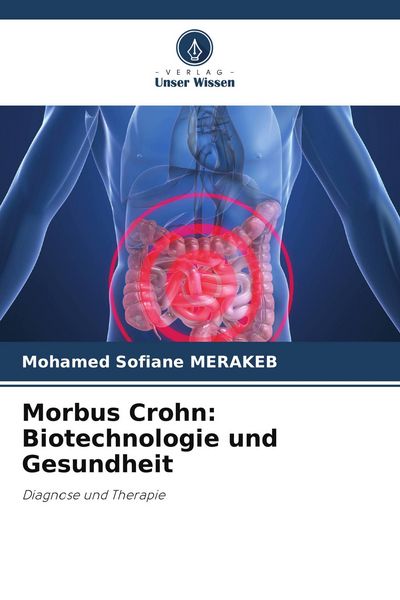 Morbus Crohn: Biotechnologie und Gesundheit, Taschenbuch von Mohamed Sofiane Merakeb, Verlag Unser Wissen, 9786209546273