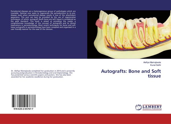 Produktbild: Autografts: Bone and Soft tissue