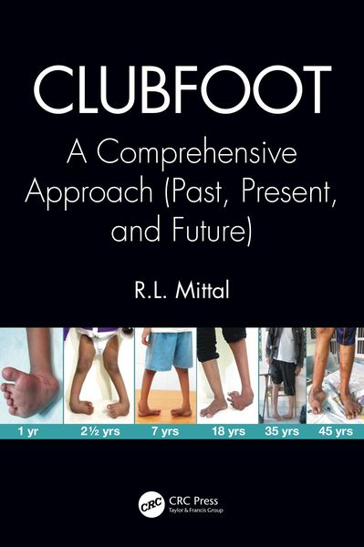 Produktbild: Clubfoot