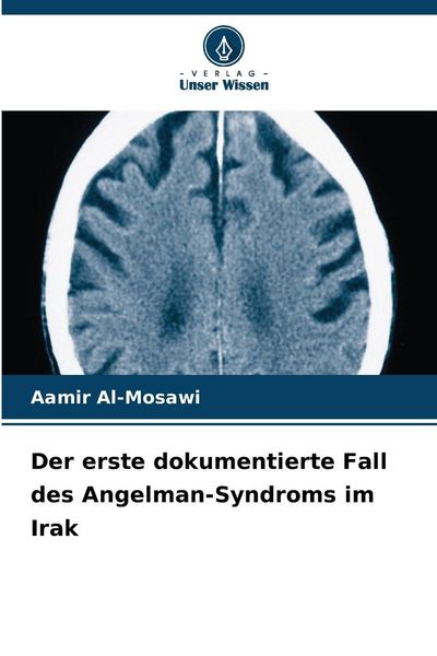 Produktbild: Der erste dokumentierte Fall des Angelman-Syndroms im Irak