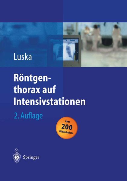 Produktbild: R&ouml;ntgenthorax auf Intensivstationen